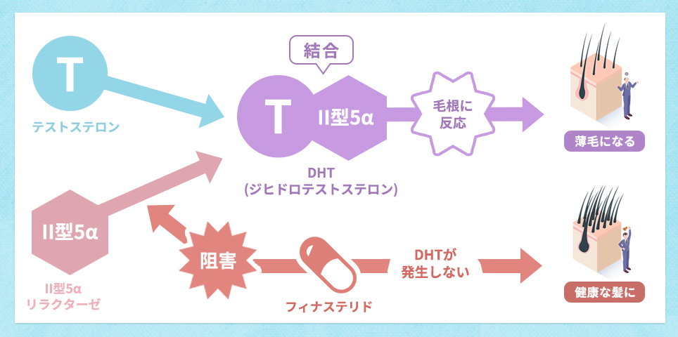 フィナステリドの仕組み