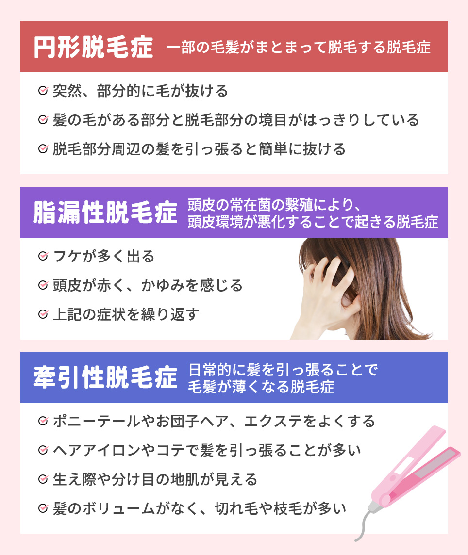 各脱毛症の特徴まとめ