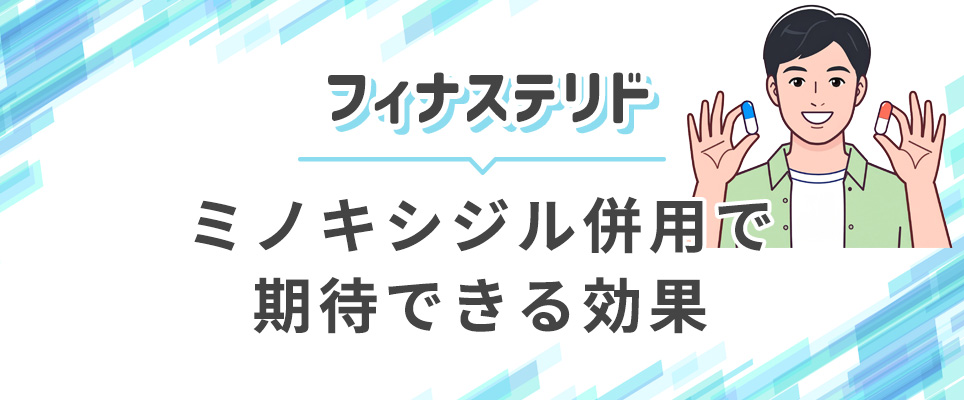 フィナステリドとミノキシジルの併用について