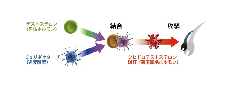 AGAが進行する仕組みの画像