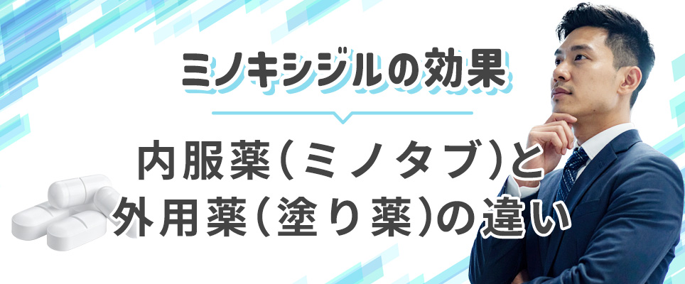 ミノキシジルの外用薬・内服薬の違い