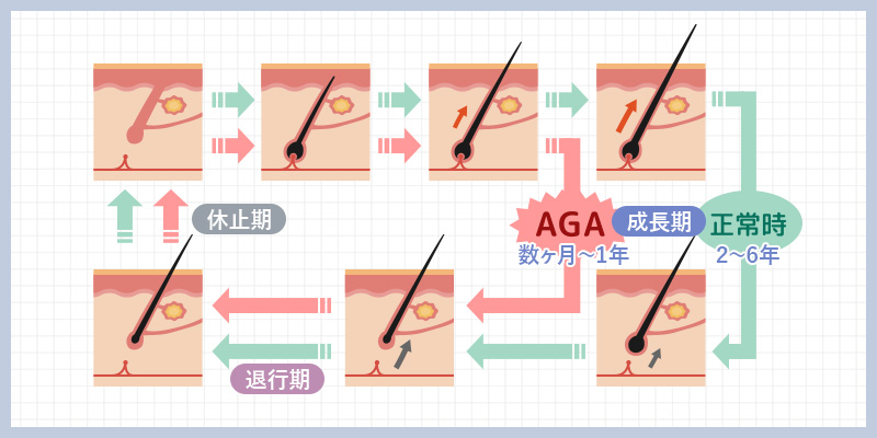 毛のサイクルの図説