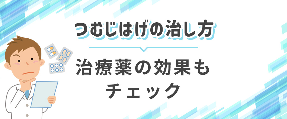 つむじはげの治療薬の効果を紹介