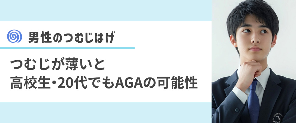 男性のつむじはげの原因