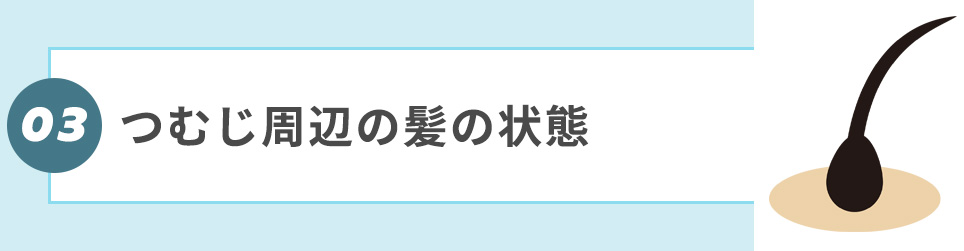 3. つむじ周辺の髪の状態