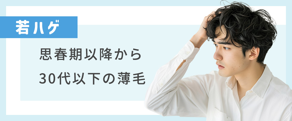 若ハゲは思春期~30代まで