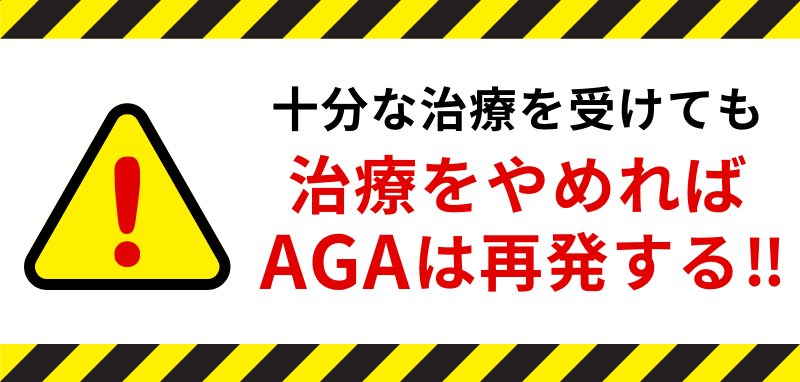 AGAは治療をやめれば再発する注意喚起