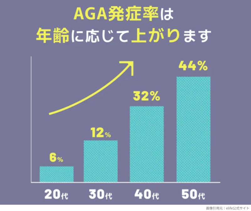 elife_AGA発症率は年齢に応じて上がる