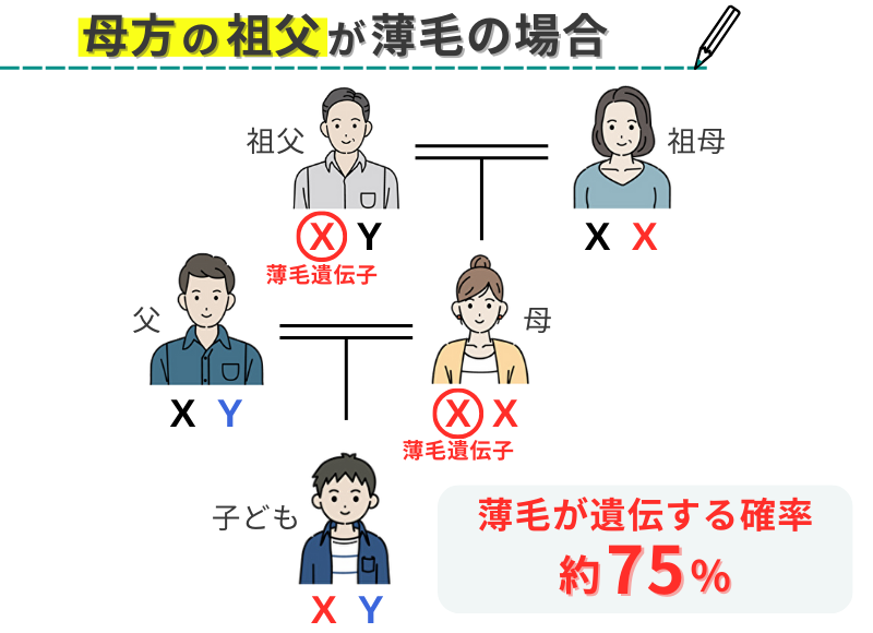 母方の祖父が薄毛の場合に遺伝する確率