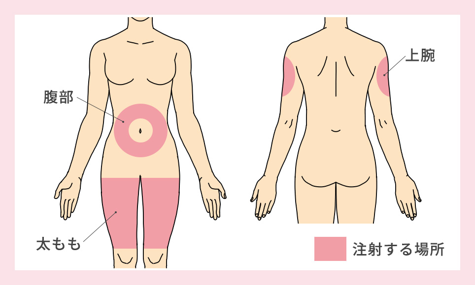 GLP-1注射する部位の図説